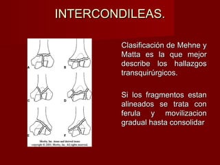 INTERCONDILEAS.

        Clasificación de Mehne y
        Matta es la que mejor
        describe los hallazgos
        transquirúrgicos.

        Si los fragmentos estan
        alineados se trata con
        ferula y movilizacion
        gradual hasta consolidar
 