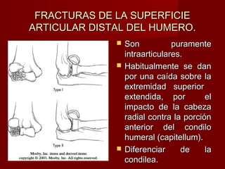 FRACTURAS DE LA SUPERFICIE
ARTICULAR DISTAL DEL HUMERO.
                 Son           puramente
                  intraarticulares.
                 Habitualmente se dan
                  por una caída sobre la
                  extremidad superior
                  extendida, por         el
                  impacto de la cabeza
                  radial contra la porción
                  anterior del condilo
                  humeral (capitellum).
                 Diferenciar     de     la
                  condilea.
 