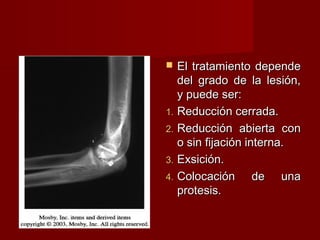   El tratamiento depende
   del grado de la lesión,
   y puede ser:
1. Reducción cerrada.
2. Reducción abierta con
   o sin fijación interna.
3. Exsición.
4. Colocación       de una
   protesis.
 