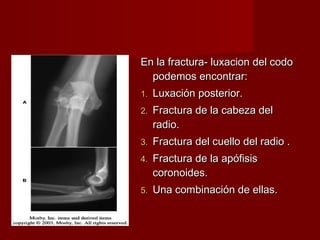 En la fractura- luxacion del codo
  podemos encontrar:
1.   Luxación posterior.
2.   Fractura de la cabeza del
     radio.
3.   Fractura del cuello del radio .
4.   Fractura de la apófisis
     coronoides.
5.   Una combinación de ellas.
 