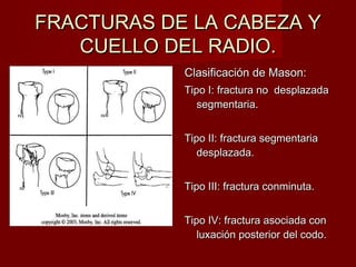 FRACTURAS DE LA CABEZA Y
   CUELLO DEL RADIO.
            Clasificación de Mason:
            Tipo I: fractura no desplazada
               segmentaria.


            Tipo II: fractura segmentaria
               desplazada.


            Tipo III: fractura conminuta.


            Tipo IV: fractura asociada con
               luxación posterior del codo.
 