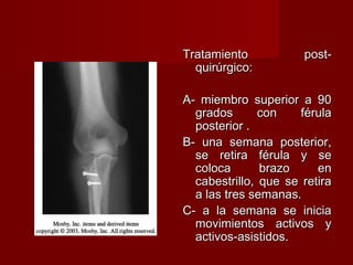 Tratamiento           post-
  quirúrgico:

A- miembro superior a 90
  grados       con    férula
  posterior .
B- una semana posterior,
  se retira férula y se
  coloca       brazo     en
  cabestrillo, que se retira
  a las tres semanas.
C- a la semana se inicia
  movimientos activos y
  activos-asistidos.
 