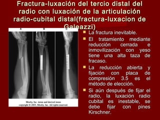 Fractura-luxación del tercio distal del
  radio con luxación de la articulación
radio-cubital distal(fractura-luxacion de
                Galeazzi)
                        La fractura inevitable.
                        El tratamiento mediante
                         reducción      cerrada  e
                         inmovilización con yeso
                         tiene una alta taza de
                         fracaso.
                        La reducción abierta y
                         fijación con placa de
                         compresión 3.5 es el
                         método de elección.
                        Si aún después de fijar el
                         radio, la luxación radio
                         cubital es inestable, se
                         debe fijar con pines
                         Kirschner.
 