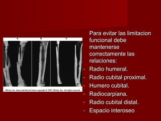 Para evitar las limitacion
    funcional debe
    mantenerse
    correctamente las
    relaciones:
-   Radio humeral.
-   Radio cubital proximal.
-   Humero cubital.
-   Radiocarpiana.
-   Radio cubital distal.
-   Espacio interoseo
 