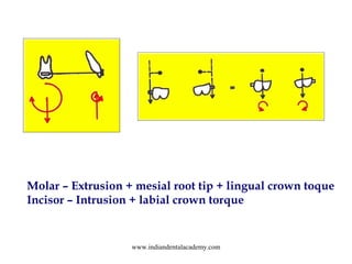 Molar – Extrusion + mesial root tip + lingual crown toque
Incisor – Intrusion + labial crown torque

www.indiandentalacade...