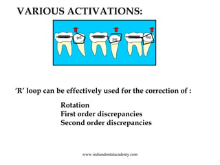 VARIOUS ACTIVATIONS:

‘R’ loop can be effectively used for the correction of :
Rotation
First order discrepancies
Second o...