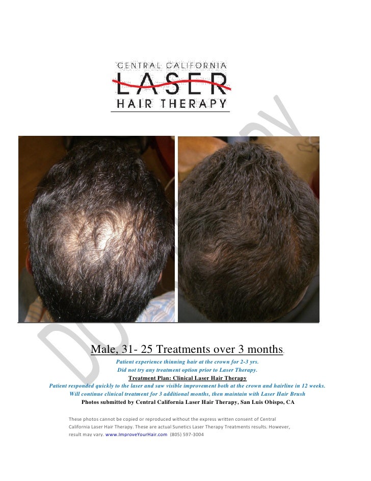 Cody D 25 Treatments