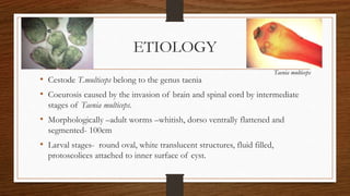 ETIOLOGY
• Cestode T.multiceps belong to the genus taenia
• Coeurosis caused by the invasion of brain and spinal cord by intermediate
stages of Taenia multiceps.
• Morphologically –adult worms –whitish, dorso ventrally flattened and
segmented- 100cm
• Larval stages- round oval, white translucent structures, fluid filled,
protoscolices attached to inner surface of cyst.
Taenia multiceps
 