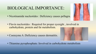 BIOLOGICAL IMPORTANCE:
• Nicotinamide nucleotides : Deficiency causes pellagra.
• Flavin nucleotides : Required for proper eyesight , involved in
carbohydrate, protein and fat metabolism.
• Coenzyme A :Deficiency causes dermatitis.
• Thiamine pyrophosphate: Involved in carbohydrate metabolism
 