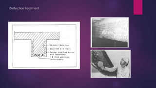 Deflection treatment
 