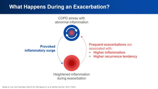 What Happens During an
Exacerbation?
 