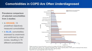 Comorbidities in COPD Are Often
Underdiagnosed
 