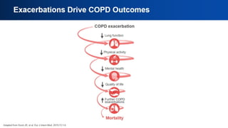 Exacerbations Drive COPD Outcomes
 