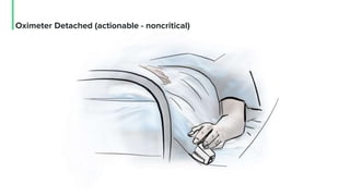 Oximeter Detached (actionable - noncritical)
 