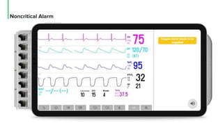 Noncritical Alarm
 