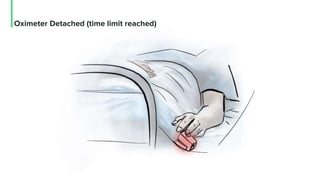 Oximeter Detached (time limit reached)
 