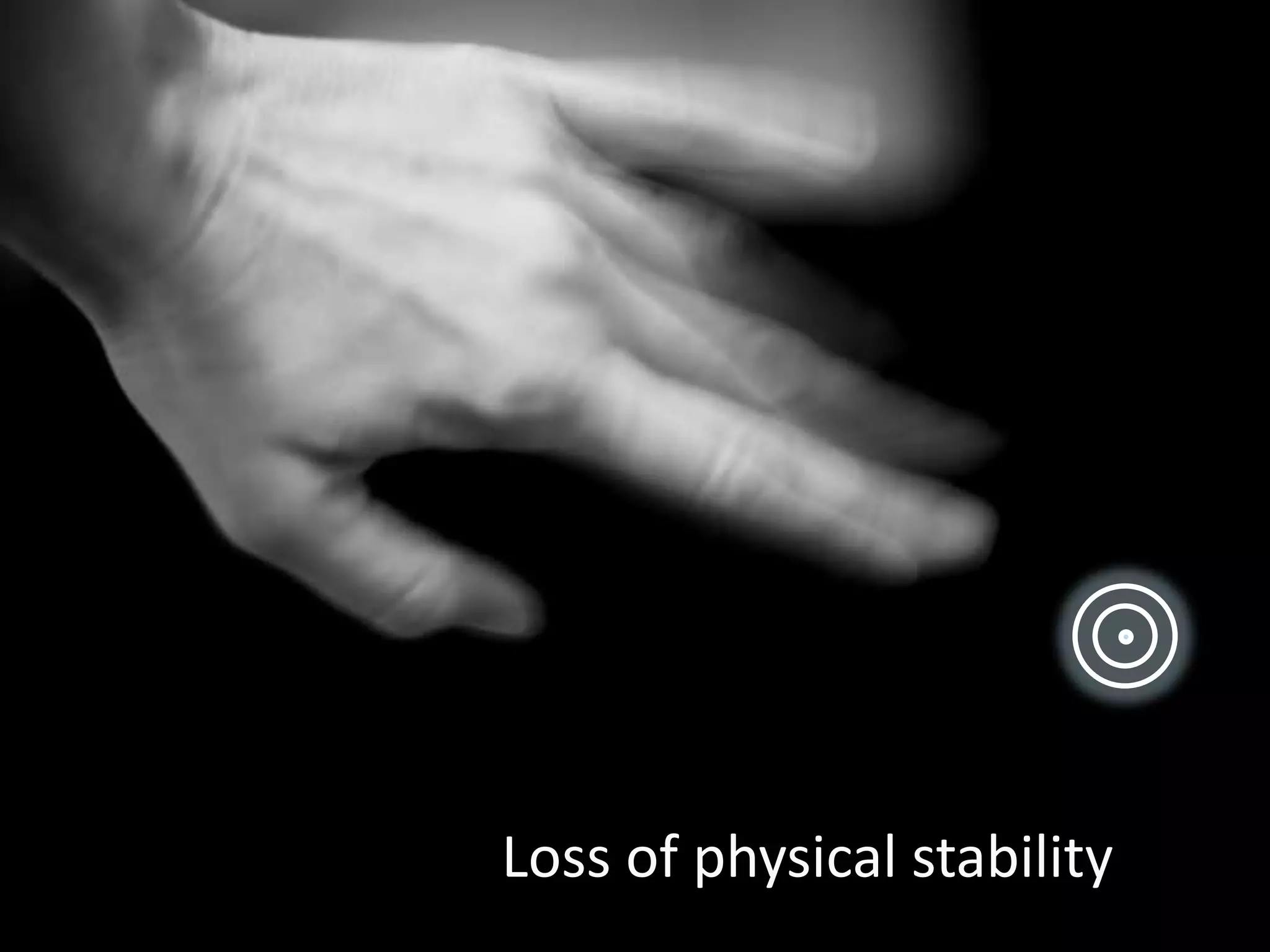 Loss of physical stability
 