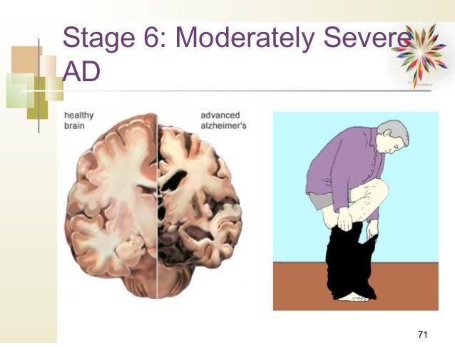 Cognitive & neurologic, delirium & dementia spring 2014