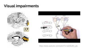 Visual impairments
https://www.youtube.com/watch?v=cG5ZuK0_qtc
 