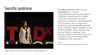 Tourette syndrome
https://www.youtube.com/watch?v=CBVJdI4yk7A
Tourette syndrome (TS or simply
Tourette's) is a common
neuropsychiatric disorder with onset in
childhood, characterized by multiple
motor tics and at least one vocal
(phonic) tic. These tics characteristically
wax and wane, can be suppressed
temporarily, and are typically preceded
by an unwanted urge or sensation in the
affected muscles. Some common tics
are eye blinking, coughing, throat
clearing, sniffing, and facial movements.
Tourette's does not adversely affect
intelligence or life expectancy.
Source:
https://en.wikipedia.org/wiki/Tourette_syndrome
 