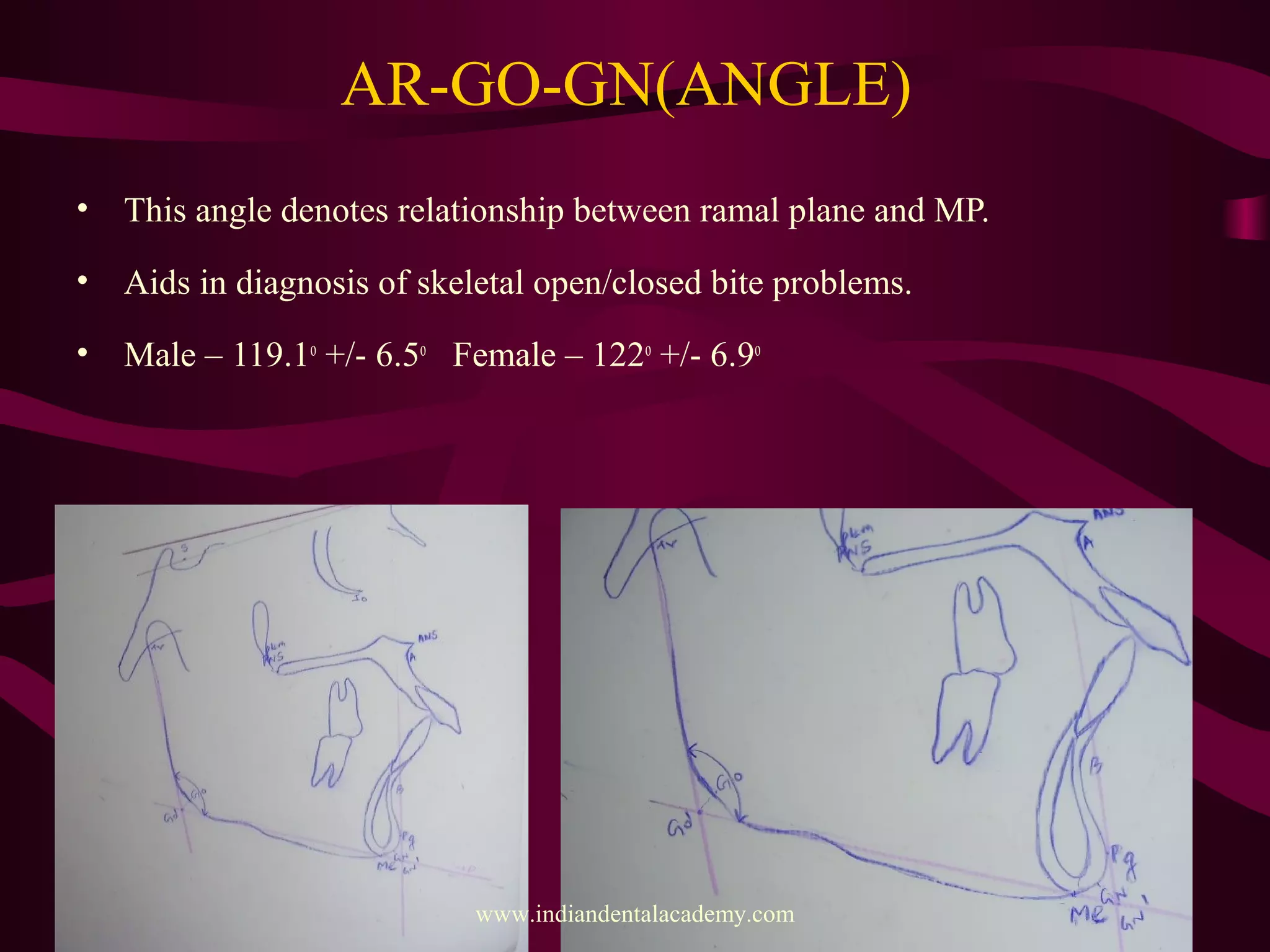 COGS analysis (Cephelometrics for orthognathic surgery) / fixed