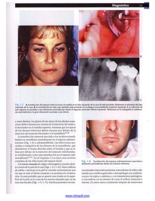 pdfree




www.nitropdf.com
 