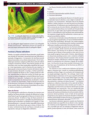 pdfree




www.nitropdf.com
 