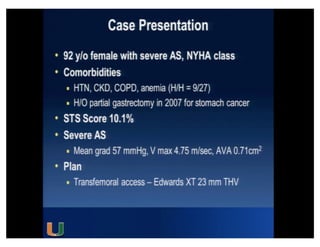 Cohen MG - AIMRADIAL 2014 - Radial and TAVI
