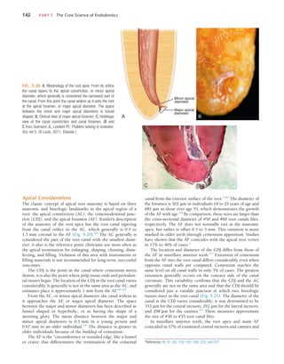 142	 PART I  The Core Science of Endodontics
canal from the exterior surface of the root.”109
The diameter of
the foramen is 502 µm in individuals 18 to 25 years of age and
681 µm in those over age 55, which demonstrates the growth
of the AF with age.109
By comparison, these sizes are larger than
the cross-sectional diameter of #50 and #60 root canals files,
respectively. The AF does not normally exit at the anatomic
apex, but rather is offset 0.5 to 3 mm. This variation is more
marked in older teeth through cementum apposition. Studies
have shown that the AF coincides with the apical root vertex
in 17% to 46% of cases.*
The location and diameter of the CDJ differ from those of
the AF in maxillary anterior teeth.174
Extension of cementum
from the AF into the root canal differs considerably, even when
opposite canal walls are compared. Cementum reaches the
same level on all canal walls in only 5% of cases. The greatest
extension generally occurs on the concave side of the canal
curvature. This variability confirms that the CDJ and the AC
generally are not in the same area and that the CDJ should be
considered just a variable junction at which two histologic
tissues meet in the root canal (Fig. 5-21). The diameter of the
canal at the CDJ varies considerably; it was determined to be
353 µm for the central incisors, 292 µm for the lateral incisors,
and 298 µm for the canines.167
These measures approximate
the size of #30 to #35 root canal files.
In maxillary anterior teeth, the root apex and main AF
coincided in 17% of examined central incisors and canines and
*References 30, 81, 83, 170, 182, 208, 223, and 227.
Apical Considerations
The classic concept of apical root anatomy is based on three
anatomic and histologic landmarks in the apical region of a
root: the apical constriction (AC), the cementodentinal junc-
tion (CDJ), and the apical foramen (AF). Kuttler’s description
of the anatomy of the root apex has the root canal tapering
from the canal orifice to the AC, which generally is 0.5 to
1.5 mm coronal to the AF (Fig. 5-20).109
The AC generally is
considered the part of the root canal with the smallest diam-
eter; it also is the reference point clinicians use most often as
the apical termination for enlarging, shaping, cleaning, disin-
fecting, and filling. Violation of this area with instruments or
filling materials is not recommended for long-term, successful
outcomes.
The CDJ is the point in the canal where cementum meets
dentin; it is also the point where pulp tissue ends and periodon-
tal tissues begin. The location of the CDJ in the root canal varies
considerably. It generally is not in the same area as the AC, and
estimates place it approximately 1 mm from the AF
.184,200
From the AC, or minor apical diameter, the canal widens as
it approaches the AF
, or major apical diameter. The space
between the major and minor diameters has been described as
funnel shaped or hyperbolic, or as having the shape of a
morning glory. The mean distance between the major and
minor apical diameters is 0.5 mm in a young person and
0.67 mm in an older individual.109
The distance is greater in
older individuals because of the buildup of cementum.
The AF is the “circumference or rounded edge, like a funnel
or crater, that differentiates the termination of the cemental
FIG. 5-20  A, Morphology of the root apex. From its orifice
the canal tapers to the apical constriction, or minor apical
diameter, which generally is considered the narrowest part of
the canal. From this point the canal widens as it exits the root
at the apical foramen, or major apical diameter. The space
between the minor and major apical diameters is funnel
shaped. B, Clinical view of major apical foramen. C, Histologic
view of the canal constriction and canal foramen. (B and
C from Gutmann JL, Lovdahl PE: Problem solving in endodon-
tics, ed 5, St Louis, 2011, Elsevier.)
Minor apical
diameter
Major apical
diameter
P
C
A B
 
