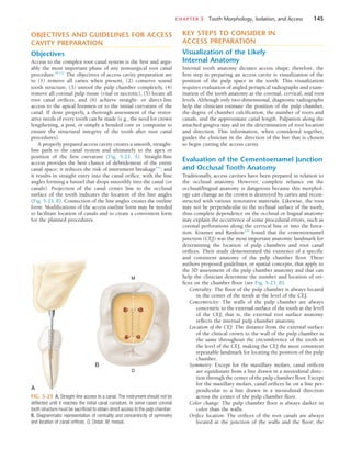 CHAPTER 5  Tooth Morphology, Isolation, and Access	 145
KEY STEPS TO CONSIDER IN
ACCESS PREPARATION
Visualization of the Likely
Internal Anatomy
Internal tooth anatomy dictates access shape; therefore, the
first step in preparing an access cavity is visualization of the
position of the pulp space in the tooth. This visualization
requires evaluation of angled periapical radiographs and exam-
ination of the tooth anatomy at the coronal, cervical, and root
levels. Although only two-dimensional, diagnostic radiographs
help the clinician estimate the position of the pulp chamber,
the degree of chamber calcification, the number of roots and
canals, and the approximate canal length. Palpation along the
attached gingiva may aid in the determination of root location
and direction. This information, when considered together,
guides the clinician in the direction of the bur that is chosen
to begin cutting the access cavity.
Evaluation of the Cementoenamel Junction
and Occlusal Tooth Anatomy
Traditionally, access cavities have been prepared in relation to
the occlusal anatomy. However, complete reliance on the
occlusal/lingual anatomy is dangerous because this morphol-
ogy can change as the crown is destroyed by caries and recon-
structed with various restorative materials. Likewise, the root
may not be perpendicular to the occlusal surface of the tooth;
thus complete dependence on the occlusal or lingual anatomy
may explain the occurrence of some procedural errors, such as
coronal perforations along the cervical line or into the furca-
tion. Krasner and Rankow107
found that the cementoenamel
junction (CEJ) was the most important anatomic landmark for
determining the location of pulp chambers and root canal
orifices. Their study demonstrated the existence of a specific
and consistent anatomy of the pulp chamber floor. These
authors proposed guidelines, or spatial concepts, that apply to
the 3D assessment of the pulp chamber anatomy and that can
help the clinician determine the number and location of ori-
fices on the chamber floor (see Fig. 5-23, B).
Centrality: The floor of the pulp chamber is always located
in the center of the tooth at the level of the CEJ.
Concentricity: The walls of the pulp chamber are always
concentric to the external surface of the tooth at the level
of the CEJ; that is, the external root surface anatomy
reflects the internal pulp chamber anatomy.
Location of the CEJ: The distance from the external surface
of the clinical crown to the wall of the pulp chamber is
the same throughout the circumference of the tooth at
the level of the CEJ, making the CEJ the most consistent
repeatable landmark for locating the position of the pulp
chamber.
Symmetry: Except for the maxillary molars, canal orifices
are equidistant from a line drawn in a mesiodistal direc-
tion through the center of the pulp chamber floor. Except
for the maxillary molars, canal orifices lie on a line per-
pendicular to a line drawn in a mesiodistal direction
across the center of the pulp chamber floor.
Color change: The pulp chamber floor is always darker in
color than the walls.
Orifice location: The orifices of the root canals are always
located at the junction of the walls and the floor; the
OBJECTIVES AND GUIDELINES FOR ACCESS
CAVITY PREPARATION
Objectives
Access to the complex root canal system is the first and argu-
ably the most important phase of any nonsurgical root canal
procedure.84,212
The objectives of access cavity preparation are
to (1) remove all caries when present, (2) conserve sound
tooth structure, (3) unroof the pulp chamber completely, (4)
remove all coronal pulp tissue (vital or necrotic), (5) locate all
root canal orifices, and (6) achieve straight- or direct-line
access to the apical foramen or to the initial curvature of the
canal. If done properly, a thorough assessment of the restor-
ative needs of every tooth can be made (e.g., the need for crown
lengthening, a post, or simply a bonded core or composite to
ensure the structural integrity of the tooth after root canal
procedures).
A properly prepared access cavity creates a smooth, straight-
line path to the canal system and ultimately to the apex or
position of the first curvature (Fig. 5-23, A). Straight-line
access provides the best chance of débridement of the entire
canal space; it reduces the risk of instrument breakage143
; and
it results in straight entry into the canal orifice, with the line
angles forming a funnel that drops smoothly into the canal (or
canals). Projection of the canal center line to the occlusal
surface of the tooth indicates the location of the line angles
(Fig. 5-23, B). Connection of the line angles creates the outline
form. Modifications of the access outline form may be needed
to facilitate location of canals and to create a convenient form
for the planned procedures.
FIG. 5-23  A, Straight-line access to a canal. The instrument should not be
deflected until it reaches the initial canal curvature. In some cases coronal
tooth structure must be sacrificed to obtain direct access to the pulp chamber.
B, Diagrammatic representation of centrality and concentricity of symmetry
and location of canal orifices. D, Distal; M, mesial.
M
D
A
B
 