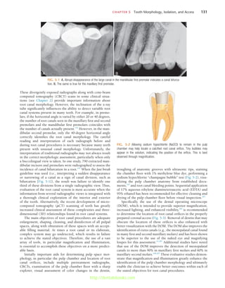 CHAPTER 5  Tooth Morphology, Isolation, and Access	 131
These divergently exposed radiographs along with cone-beam
computed tomography (CBCT) scans in some clinical situa-
tions (see Chapter 2) provide important information about
root canal morphology. However, the inclination of the x-ray
tube significantly influences the ability to detect variable root
canal systems present in many teeth. For example, in premo-
lars, if the horizontal angle is varied by either 20 or 40 degrees,
the number of root canals seen in the maxillary first and second
premolars and the mandibular first premolars coincides with
the number of canals actually present.134
However, in the man-
dibular second premolar, only the 40-degree horizontal angle
correctly identifies the root canal morphology. The careful
reading and interpretation of each radiograph before and
during root canal procedures is necessary because many teeth
present with unusual canal morphology. Unfortunately, the
interpretation of traditional radiographs may not always result
in the correct morphologic assessment, particularly when only
a buccolingual view is taken. In one study, 790 extracted man-
dibular incisors and premolars were radiographed to assess the
incidence of canal bifurcation in a root.147
When the fast break
guideline was used (i.e., interpreting a sudden disappearance
or narrowing of a canal as a sign of canal division, such as
bifurcation [Fig. 5-1]), the result was failure to identify one
third of these divisions from a single radiographic view. Thus,
evaluation of the root canal system is most accurate when the
information from several radiographic views is integrated with
a thorough clinical exploration of the interior and exterior
of the tooth. Alternatively, the recent development of micro-
computed tomography (µCT) scanning of teeth has greatly
increased clinical assessment of these complexities and three-
dimensional (3D) relationships found in root canal systems.
The main objectives of root canal procedures are adequate
enlargement, shaping, cleaning, and disinfection of all pulpal
spaces, along with obturation of these spaces with an accept-
able filling material. At times a root canal or its elaborate,
complex system may go undetected, which results in failure
to achieve the stated objectives. Therefore, the use of a vast
array of tools, in particular magnification and illumination,
is essential to accomplish these objectives on a more predict-
able basis.
Initially important aids for determining pulp space mor-
phology, in particular the pulp chamber and location of root
canal orifices, include multiple pretreatment radiographs,
CBCTs, examination of the pulp chamber floor with a sharp
explorer, visual assessment of color changes in the dentin,
FIG. 5-1  A, Abrupt disappearance of the large canal in the mandibular first premolar indicates a canal bifurca-
tion. B, The same is true for the maxillary first premolar.
A B
FIG. 5-2  Allowing sodium hypochlorite (NaOCl) to remain in the pulp
chamber may help locate a calcified root canal orifice. Tiny bubbles may
appear in the solution, indicating the position of the orifice. This is best
observed through magnification.
troughing of anatomic grooves with ultrasonic tips, staining
the chamber floor with 1% methylene blue dye, performing a
sodium hypochlorite “champagne bubble” test (Fig. 5-2), visu-
alizing the pulp chamber anatomy from established docu-
ments,107
and root canal bleeding points. Sequential application
of 17% aqueous ethylene diaminetetraacetic acid (EDTA) and
95% ethanol has been recommended for effective cleaning and
drying of the pulp chamber floor before visual inspection.207
Specifically, the use of the dental operating microscope
(DOM), which is intended to provide superior magnification,
increased lighting, and enhanced visibility,182
is recommended
to determine the location of root canal orifices in the properly
prepared coronal access (Fig. 5-3). Removal of dentin that may
obscure the location of these orifices is also enhanced with
better visualization with the DOM. The DOM also improves the
identification of extra canals (e.g., the mesiopalatal canal found
in many first and second maxillary molars) and has been shown
to be superior to the use of the naked eye and magnifying
loupes for this assessment.14,187
Additional studies have noted
that use of the DOM improves the detection of mesiopalatal
canals to more than 90% in maxillary first molars and 60% in
maxillary second molars.108,207
These evaluative studies demon-
strate that magnification and illumination greatly enhance the
identification of the pulp chamber morphology and ultimately
enable the clinician to achieve better outcomes within each of
the stated objectives for root canal procedures.
http://dentalebooks.com
 