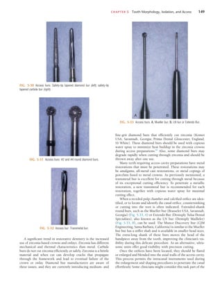 CHAPTER 5  Tooth Morphology, Isolation, and Access	 149
fine-grit diamond burs that efficiently cut zirconia (Komet
USA, Savannah, Georgia; Prima Dental Gloucester, England;
SS White). These diamond burs should be used with copious
water spray to minimize heat buildup in the zirconia crowns
during access preparations.84
Also, some diamond burs may
degrade rapidly when cutting through zirconia and should be
thrown away after one use.
Many teeth requiring access cavity preparations have metal
restorations that must be penetrated. These restorations may
be amalgams, all-metal cast restorations, or metal copings of
porcelain fused to metal crowns. As previously mentioned, a
transmetal bur is excellent for cutting through metal because
of its exceptional cutting efficiency. To penetrate a metallic
restoration, a new transmetal bur is recommended for each
restoration, together with copious water spray for maximal
cutting effect.
When a receded pulp chamber and calcified orifice are iden-
tified, or to locate and identify the canal orifice, countersinking
or cutting into the root is often indicated. Extended-shank
round burs, such as the Mueller bur (Brasseler USA, Savannah,
Georgia) (Fig. 5-33, A) or Extendo Bur (Dentsply Tulsa Dental
Specialties), also known as the LN bur (Dentsply Maillefer)
(Fig. 5-33, B), can be used. The Munce Discovery bur (CJM
Engineering, Santa Barbara, California) is similar to the Mueller
bur but has a stiffer shaft and is available in smaller head sizes.
The extra-long shank of these burs moves the head of the
handpiece away from the tooth, improving the clinician’s vis-
ibility during this delicate procedure. As an alternative, ultra-
sonic units offer good visibility with precision cutting.
Once the orifices have been located, they should be flared
or enlarged and blended into the axial walls of the access cavity.
This process permits the intracanal instruments used during
the enlargement and shaping procedures to penetrate the canal
effortlessly. Some clinicians might consider this task part of the
A significant trend in restorative dentistry is the increased
use of zirconia-based crowns and onlays. Zirconia has different
mechanical and thermal characteristics than metal. Carbide
burs do not cut zirconia efficiently or safely. Zirconia is a brittle
material and when cut can develop cracks that propagate
through the framework and lead to eventual failure of the
crown or onlay. Diamond bur manufacturers are aware of
these issues, and they are currently introducing medium- and
FIG. 5-30  Access burs: Safety-tip tapered diamond bur (left); safety-tip
tapered carbide bur (right).
FIG. 5-31  Access burs: #2 and #4 round diamond burs.
FIG. 5-32  Access bur: Transmetal bur.
FIG. 5-33  Access burs. A, Mueller bur. B, LN bur or Extendo Bur.
A B
 