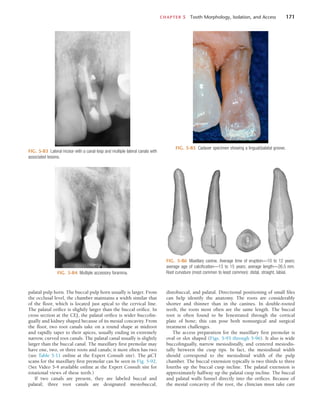 CHAPTER 5  Tooth Morphology, Isolation, and Access	 171
FIG. 5-83  Lateral incisor with a canal loop and multiple lateral canals with
associated lesions.
FIG. 5-84  Multiple accessory foramina.
FIG. 5-85  Cadaver specimen showing a lingual/palatal groove.
FIG. 5-86  Maxillary canine. Average time of eruption—10 to 12 years;
average age of calcification—13 to 15 years; average length—26.5 mm.
Root curvature (most common to least common): distal, straight, labial.
palatal pulp horn. The buccal pulp horn usually is larger. From
the occlusal level, the chamber maintains a width similar that
of the floor, which is located just apical to the cervical line.
The palatal orifice is slightly larger than the buccal orifice. In
cross section at the CEJ, the palatal orifice is wider buccolin-
gually and kidney shaped because of its mesial concavity. From
the floor, two root canals take on a round shape at midroot
and rapidly taper to their apices, usually ending in extremely
narrow, curved root canals. The palatal canal usually is slightly
larger than the buccal canal. The maxillary first premolar may
have one, two, or three roots and canals; it most often has two
(see Table 5-11 online at the Expert Consult site). The µCT
scans for the maxillary first premolar can be seen in Fig. 5-92.
(See Video 5-4 available online at the Expert Consult site for
rotational views of these teeth.)
If two canals are present, they are labeled buccal and
palatal; three root canals are designated mesiobuccal,
distobuccal, and palatal. Directional positioning of small files
can help identify the anatomy. The roots are considerably
shorter and thinner than in the canines. In double-rooted
teeth, the roots most often are the same length. The buccal
root is often found to be fenestrated through the cortical
plate of bone; this can pose both nonsurgical and surgical
treatment challenges.
The access preparation for the maxillary first premolar is
oval or slot shaped (Figs. 5-93 through 5-96). It also is wide
buccolingually, narrow mesiodistally, and centered mesiodis-
tally between the cusp tips. In fact, the mesiodistal width
should correspond to the mesiodistal width of the pulp
chamber. The buccal extension typically is two thirds to three
fourths up the buccal cusp incline. The palatal extension is
approximately halfway up the palatal cusp incline. The buccal
and palatal walls funnel directly into the orifices. Because of
the mesial concavity of the root, the clinician must take care
 