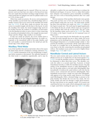 CHAPTER 5  Tooth Morphology, Isolation, and Access	 183
FIG. 5-118  Four canals with two distinct palatal roots and canals.
FIG. 5-119  Maxillary third molar. Average time of eruption—17 to 22 years; average age of calcification—18
to 25 years; average length—17 mm.
distoangular radiograph may be exposed. When two roots are
present, each root may have one canal, or the buccal root may
have two canals that join before reaching a single foramen. One
study found that two palatal roots and two palatal canals occur
in 1.47% of these teeth.166
When four canals are present, the access cavity preparation
of the maxillary second molar has a rhomboid shape and is a
smaller version of the access cavity for the maxillary first molar
(see Fig. 5-115). If only three canals are present, the access
cavity is a rounded triangle with the base to the buccal. As with
the maxillary first molar, the mesial marginal ridge need not
be invaded. Because the tendency in maxillary second molars
is for the distobuccal orifice to move closer to a line connecting
the mesiobuccal and palatal orifices, the triangle becomes more
obtuse and the oblique ridge usually is not invaded.
If only two canals are present, the access outline form is
oval and widest in the buccolingual dimension. Its width cor-
responds to the mesiodistal width of the pulp chamber, and
the oval usually is centered between the mesial pit and the
mesial edge of the oblique ridge.
Maxillary Third Molar
Loss of the maxillary first and second molars often is the reason
the third molar must be considered a strategic abutment (Fig.
5-119). Careful examination of the root morphology is impor-
tant before treatment is determined. The radicular anatomy of
the third molar is completely unpredictable, and it may be
advisable to explore the root canal morphology to evaluate the
likelihood and degree of success. Even so, many third molars
have adequate root formation; given reasonable accessibility,
they can serve well as functioning dentition after root canal
therapy.
The root anatomy of the maxillary third molar varies greatly.
This tooth can have one to four roots and one to six canals,
and C-shaped canals also can occur. The third molar usually
has three roots and three root canals (see Table 5-19 online at
the Expert Consult site). The tooth may be tipped significantly
to the distal, the buccal, or both, which creates an even greater
access problem than with the second molar. The µCT scans
for the maxillary molar can be seen in Fig. 5-120. (See Video
5-8 online at the Expert Consult site for rotational views of
these teeth.)
The access cavity form for the third molar can vary greatly.
Because the tooth typically has one to three canals, the access
preparation can be anything from an oval that is widest in the
buccolingual dimension to a rounded triangle similar to that
used for the maxillary second molar. All the canal orifices often
lie nearly in a straight line as the distobuccal orifice moves
even closer to the line connecting the mesiobuccal and palatal
orifices. The resultant access cavity is an oval or highly obtuse
triangle (Figs. 5-121 and 5-122).
Mandibular Central and Lateral Incisors
The root canal systems and access cavities for the two man-
dibular incisors are so similar they are discussed together (Fig.
5-123). As with the maxillary incisors, a lingual shoulder must
be eliminated to allow direct-line access. The shoulder con-
ceals the orifice to a second canal that, if present, is found
immediately beneath it. Unlike the maxillary incisors, the pulp
outline of the mandibular incisors is wider labiolingually. At
the CEJ the pulp outline is oval and wider labiolingually than
mesiodistally. At midroot the canal outline is still oval, but the
canal is more constricted and narrower labiolingually. Most
mandibular incisors have a single root with what radiographi-
cally appears to be a long, narrow canal. However, it is a broad
canal labiolingually. Often a dentinal bridge is present in the
pulp chamber that divides the root into two canals. The two
canals usually join and exit through a single apical foramen,
but they may persist as two separate canals. On occasion one
canal branches into two canals, which subsequently rejoin into
a single canal before reaching the apex (see Table 5-20 online
 