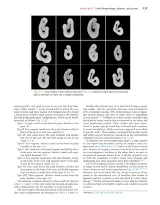 CHAPTER 5  Tooth Morphology, Isolation, and Access	 137
FIG. 5-11  Cross sections of teeth similar to those seen in Fig. 5-10 amplify the unique nature of the root canal
system, particularly its ribbon and C-shaped configurations.
categorized the root canal systems in any root into four basic
types. Other studies,225
using cleared teeth in which the root
canal systems had been stained with hematoxylin dye, found
a much more complex canal system. In doing so the authors
identified eight pulp space configurations, which can be briefly
described as follows (Fig. 5-12):
Type I: A single canal extends from the pulp chamber to the
apex (1).
Type II: Two separate canals leave the pulp chamber and join
short of the apex to form one canal (2-1).
Type III: One canal leaves the pulp chamber and divides
into two in the root; the two then merge to exit as one
canal (1-2-1).
Type IV: Two separate, distinct canals extend from the pulp
chamber to the apex (2).
Type V: One canal leaves the pulp chamber and divides short
of the apex into two separate, distinct canals with sepa-
rate apical foramina (1-2).
Type VI: Two separate canals leave the pulp chamber, merge
in the body of the root, and separate short of the apex
to exit as two distinct canals (2-1-2).
Type VII: One canal leaves the pulp chamber, divides and
then rejoins in the body of the root, and finally separates
into two distinct canals short of the apex (1-2-1-2).
Type VIII: Three separate, distinct canals extend from the
pulp chamber to the apex (3).
The anatomic variations present in these teeth are listed in
Tables 5-1 and 5-2. The only tooth that showed all eight pos-
sible configurations was the maxillary second premolar.
The percentages of human permanent teeth with these vari-
able canal configurations are presented in Tables 5-3 and 5-4. *References 82, 100, 190, 219, 229-231, and 236.
Similar observations have been described in large popula-
tion studies with the exceptions that one canal was found in
23% of maxillary laterals, 55% of mesiobuccal roots of maxil-
lary second molars, and 30% of distal roots of mandibular
second molars.33,242
Differences in these studies, from the types
described by Weine, may be due to variations in the ethnic and
racial populations studied. Other studies that were ethnic,
racial, or gender-specific based have indicated wide variations
in canal morphology, which sometimes appeared more often
in specific teeth.* These authors concluded that gender, racial,
and ethnic aspects should be considered in the pretreatment
evaluation for root canal procedures (Fig. 5-13).
In addition to in vitro morphologic studies, a large number
of case reports has described a variety of complex canal con-
figurations (see Tables 5-8 to 5-27 online at the Expert Consult
site). Reports of complex anatomy from both in vitro and in
vivo investigations contribute to the adage that it is easier to
recognize an anatomic feature if one is already prepared to see
it. With the availability of CBCT, many more irregular and
challenging root canal anatomies have been identified.168,217
One well-recognized ethnic variant is the higher incidence
of single-rooted and C-shaped mandibular second molars in
Native American and Asians populations (Fig. 5-14).62,63,130,131
However, this is not always the case, as the occurrence of two
canals in the mesiobuccal root of maxillary first molars in
Japanese patients is similar to that described for other ethnic
groups.239
All this information makes it clear that the clinician
is confronted daily with highly complex and variable root canal
systems.
 