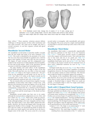 CHAPTER 5  Tooth Morphology, Isolation, and Access	 199
FIG. 5-160  Mandibular second molar. Average time of eruption—11 to 13 years; average age of
calcification—14 to 15 years; average length—19.8 mm. Root curvature (most common to least common):
mesial root—distal, straight; distal root—straight, distal, mesial, buccal; single root—straight, distal, bayonet,
lingual.
these orifices.32
These anatomic variations present definite
challenges to therapy because of their orifice inclination and
root canal curvature. The canal can be straight, may have a
coronal curvature, or can have separate coronal and apical
curvatures.52
Mandibular Second Molar
The mandibular second molar is somewhat smaller coronally
than the first molar and tends to be more symmetric (Fig.
5-160). This tooth is identified by the proximity of its roots.
The two roots often sweep distally in a gradual curve, with the
apices close together. In some cases only one root is present.
The degree of canal curvature and the configuration were
studied in the mesial roots of 100 randomly selected mandibu-
lar first and second molars; 100% of the specimens showed
curvature in both buccolingual and mesiodistal views.45
The pulp chamber and canal orifices of the mandibular
second molar generally are not as large as those of the first
molar. This tooth may have one, two, three, or four root canals
(see Table 5-26 online at the Expert Consult site). The µCT
scans for the mandibular second molar can be seen in Fig.
5-161. (See Video 5-15 online at the Expert Consult site for
rotational views of these teeth.) Figs. 5-162 through 5-166
provide additional variations and views of this tooth.
The two mesial orifices are located closer together. In some
mandibular second molars with single or fused roots, a file
placed in the mesiobuccal canal may appear to be in the distal
canal. This happens because the two canals sometimes are
connected by a semicircular slit, a variation of the C-shaped
canal137,234,262
that often occurs in this tooth. The distal aspect
of the mesial root and the mesial aspect of the distal root have
concavities.
Mandibular second molars may have one to six canals,
although the most prevalent configurations are two, three, and
four canals (see Fig. 5-162). When three canals are present,
the access cavity is similar to that for the mandibular first
molar, although perhaps a bit more triangular and less rhom-
boid. The distal orifice is less often ribbon shaped buccolin-
gually; therefore, the buccal and lingual walls converge more
aggressively distally to form a triangle. The second molar may
have only two canals, one mesial and one distal, in which case
the orifices are nearly equal in size and line up in the bucco-
lingual center of the tooth. The access cavity for a two-canal
second molar is rectangular, wide mesiodistally and narrow
buccolingually. The access cavity for a single-canal mandibular
second molar is oval and is lined up in the center of the occlu-
sal surface.
Mandibular Third Molar
The mandibular third molar is anatomically unpredictable
and must be evaluated on the basis of its root formation
(Fig. 5-167).110
Fused short, severely curved, or malformed
roots often support well-formed crowns. This tooth may have
one to four roots and one to six canals (see Table 5-27
online at the Expert Consult site). The µCT scans for the
mandibular third molar can be seen in Fig. 5-168. (See Video
5-16 online at the Expert Consult site for rotational views of
these teeth.) Additional variations are seen in Figs. 5-169
through 5-171.
C-shaped canals also can occur (Fig. 5-172). Most of these
teeth can be successfully root treated, regardless of anatomic
irregularities; however, the long-term prognosis is determined
by the root surface volume in contact with bone. The clinician
must weigh the benefit of treatment against the prognosis.
The anatomy of the mandibular third molar is unpredict-
able; therefore, the access cavity can take any of several shapes.
When three or more canals are present, a traditional rounded
triangle or rhomboid shape is typical. When two canals are
present, a rectangular shape is used. For single-canal molars,
an oval shape is customary.
Teeth with C-Shaped Root Canal Systems
The main cause for C-shaped roots and canals is the failure of
Hertwig’s epithelial root sheath to fuse on either the buccal or
lingual root surface (Fig. 5-173). The C-shaped canal system
can assume many variations in its morphology (Fig. 5-174, A).
Further cross section of types I, II, and III are seen in Fig. 5-174,
B to D. The original classification133
has been modified and has
produced a more detailed description of C-shaped root and
canal morphology. The C-shaped canal configuration can vary
along the root depth so that the appearance of the orifices may
not be good predictors of the actual canal anatomy.62,64,137,234,262
Category I (C1): The shape is an uninterrupted “C” with
no separation or division (see Fig. 5-163, A).
Category II (C2): The canal shape resembles a semicolon
resulting from a discontinuation of the “C” outline (see
 