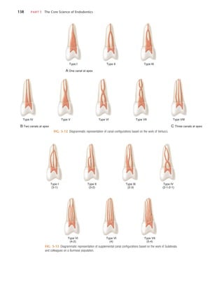 138	 PART I  The Core Science of Endodontics
FIG. 5-12  Diagrammatic representation of canal configurations based on the work of Vertucci.
A One canal at apex
Type I Type II Type III
B Two canals at apex
Type IV Type V Type VI Type VII
C Three canals at apex
Type VIII
FIG. 5-13  Diagrammatic representation of supplemental canal configurations based on the work of Gulabivala
and colleagues on a Burmese population.
Type I
(3-1)
Type VI
(4-2)
Type VI
(4)
Type VII
(5-4)
Type II
(3-2)
Type III
(2-3)
Type IV
(2-1-2-1)
 