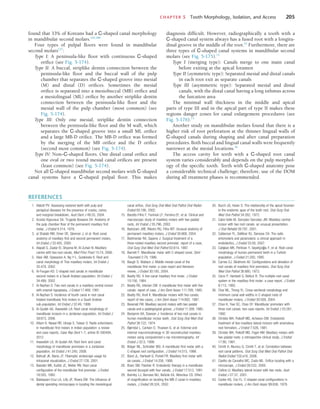 CHAPTER 5  Tooth Morphology, Isolation, and Access	 205
found that 33% of Koreans had a C-shaped canal morphology
in mandibular second molars.105,189
Four types of pulpal floors were found in mandibular
second molars137
:
Type I: A peninsula-like floor with continuous C-shaped
orifice (see Fig. 5-174).
Type II: A buccal, striplike dentin connection between the
peninsula-like floor and the buccal wall of the pulp
chamber that separates the C-shaped groove into mesial
(M) and distal (D) orifices. Sometimes the mesial
orifice is separated into a mesiobuccal (MB) orifice and
a mesiolingual (ML) orifice by another striplike dentin
connection between the peninsula-like floor and the
mesial wall of the pulp chamber (most common) (see
Fig. 5-174).
Type III: Only one mesial, striplike dentin connection
between the peninsula-like floor and the M wall, which
separates the C-shaped groove into a small ML orifice
and a large MB-D orifice. The MB-D orifice was formed
by the merging of the MB orifice and the D orifice
(second most common) (see Fig. 5-174).
Type IV: Non–C-shaped floors. One distal canal orifice and
one oval or two round mesial canal orifices are present
(least common) (see Fig. 5-174).
Not all C-shaped mandibular second molars with C-shaped
canal systems have a C-shaped pulpal floor. This makes
diagnosis difficult. However, radiographically a tooth with a
C-shaped canal system always has a fused root with a longitu-
dinal groove in the middle of the root.63
Furthermore, there are
three types of C-shaped canal systems in mandibular second
molars (see Fig. 5-175).73
Type I (merging type): Canals merge to one main canal
before exiting at the apical foramen
Type II (symmetric type): Separated mesial and distal canals
in each root exit as separate canals
Type III (asymmetric type): Separated mesial and distal
canals, with the distal canal having a long isthmus across
the furcation area
The minimal wall thickness in the middle and apical
parts of type III and in the apical part of type II makes these
regions danger zones for canal enlargement procedures (see
Fig. 5-176).73
Another study on mandibular molars found that there is a
higher risk of root perforation at the thinner lingual walls of
C-shaped canals during shaping and after canal preparation
procedures. Both buccal and lingual canal walls were frequently
narrower at the mesial locations.36
The access cavity for teeth with a C-shaped root canal
system varies considerably and depends on the pulp morphol-
ogy of the specific tooth. Teeth with C-shaped anatomy pose
a considerable technical challenge; therefore, use of the DOM
during all treatment phases is recommended.
REFERENCES
1.	 Abbott PV: Assessing restored teeth with pulp and
periapical diseases for the presence of cracks, caries,
and marginal breakdown, Aust Dent J 49:33, 2004.
2.	 Acosta Vigouraux SA, Trugeda Bosaans SA: Anatomy of
the pulp chamber floor of the permanent maxillary first
molar, J Endod 4:214, 1978.
3.	 al Shalabi RM, Omer OE, Glennon J, et al: Root canal
anatomy of maxillary first and second permanent molars,
Int Endod J 33:405, 2000.
4.	 Alapati S, Zaatar EI, Shyama M, Al-Zuhair N: Maxillary
canine with two root canals, Med Princ Pract 15:74, 2006.
5.	 Alavi AM, Opasanon A, Ng Y-L, Gulabivala K: Root and
canal morphology of Thai maxillary molars, Int Endod J
35:478, 2002.
6.	 Al-Fougan KS: C-shaped root canals in mandibular
second molars in a Saudi Arabian population, Int Endod J
34:499, 2002.
7.	 Al-Nazhan S: Two root canals in a maxillary central incisor
with enamel hypoplasia, J Endod 17:469, 1991.
8.	 Al-Nazhan S: Incidence of fourth canal in root canal
treated mandibular first molars in a Saudi Arabian
sub-population, Int Endod J 32:49, 1999.
9.	 Al-Qudah AA, Awawdeh LA: Root canal morphology of
mandibular incisors in a Jordanian population, Int Endod J
39:873, 2006.
10.	 Attam K, Nawal RR, Utneja S, Talwar S: Radix entomolaris
in mandibular first molars in Indian population: a review
and case reports, Case Rep Dent 1-7, article ID 595494,
2012.
11.	 Awawdeh LA, Al-Qudah AA: Root form and canal
morphology of mandibular premolars in a Jordanian
population, Int Endod J 41:240, 2008.
12.	 Bahcall JK, Barss JT: Fiberoptic endoscope usage for
intracanal visualization, J Endod 27:128, 2001.
13.	 Baisden MK, Kulilid JC, Weller RN: Root canal
configuration of the mandibular first premolar, J Endod
18:505, 1992.
14.	 Baldassari-Cruz LA, Lilly JP, Rivera EM: The influence of
dental operating microscopes in locating the mesiolingual
canal orifice, Oral Surg Oral Med Oral Pathol Oral Radiol
Endod 93:190, 2002.
15.	 Baratto-Filho F, Fariniuk LF, Ferreira EF, et al: Clinical and
macroscopic study of maxillary molars with two palatal
roots, Int Endod J 35:796, 2002.
16.	 Barbizam JVB, Ribeiro RG, Filho MT: Unusual anatomy of
permanent maxillary molars, J Endod 30:668, 2004.
17.	 Barkhordar RA, Sapone J: Surgical treatment of a
three-rooted maxillary second premolar: report of a case,
Oral Surg Oral Med Oral Pathol 63:614, 1987.
18.	 Barnett F: Mandibular molar with C-shaped canal, Dent
Traumatol 2:79, 1986.
19.	 Baugh D, Wallace J: Middle mesial canal of the
mandibular first molar: a case report and literature
review, J Endod 30:185, 2004.
20.	 Beatty RG: A five-canal maxillary first molar, J Endod
10:156, 1984.
21.	 Beatty RG, Interian CM: A mandibular first molar with five
canals: report of case, J Am Dent Assoc 111:769, 1985.
22.	 Beatty RG, Krell K: Mandibular molars with five canals:
report of two cases, J Am Dent Assoc 114:802, 1987.
23.	 Benenati FW: Maxillary second molars with two palatal
canals and a palatogingival groove, J Endod 11:308, 1985.
24.	 Benjamin KA, Dowson J: Incidence of two root canals in
human mandibular incisor teeth, Oral Surg Oral Med Oral
Pathol 38:122, 1974.
25.	 Bjørndal L, Carlsen O, Thuesen G, et al: External and
internal macromorphology in 3D reconstructed maxillary
molars using computerized x-ray microtomography, Int
Endod J 32:3, 1999.
26.	 Bolger WL, Schindler WG: A mandibular first molar with a
C-shaped root configuration, J Endod 14:515, 1998.
27.	 Bond JL, Hartwell G, Portell FR: Maxillary first molar with
six canals, J Endod 14:258, 1988.
28.	 Bram SM, Fleisher R: Endodontic therapy in a mandibular
second bicuspid with four canals, J Endod 17:513, 1991.
29.	 Buhrley LJ, Barrows MJ, BeGole EA, Wenckus CS: Effect
of magnification on locating the MB-2 canal in maxillary
molars, J Endod 28:324, 2002.
30.	 Burch JG, Hulen S: The relationship of the apical foramen
to the anatomic apex of the tooth root, Oral Surg Oral
Med Oral Pathol 34:262, 1972.
31.	 Cabo-Valle M, Gonzalez-Gonzalez JM: Maxillary central
incisor with two root canals: an unusual presentation,  
J Oral Rehabil 28:797, 2001.
32.	 Calberson FL, DeMoor RJ, Deroose CA: The radix
entomolaris and paramolaris: a clinical approach in
endodontics, J Endod 33:58, 2007.
33.	 Calişkan MK, Pehlivan Y, Sepetçioǧlu F, et al: Root canal
morphology of human permanent teeth in a Turkish
population, J Endod 21:200, 1995.
34.	 Carnes EJ, Skidmore AE: Configurations and deviation of
root canals of maxillary first premolars, Oral Surg Oral
Med Oral Pathol 36:880, 1973.
35.	 Cecic P, Hartwell G, Bellizzi R: The multiple root canal
system in the maxillary first molar: a case report, J Endod
8:113, 1982.
36.	 Chai WL, Thong YL: Cross-sectional morphology and
minimum canal wall widths in C-shaped roots of
mandibular molars, J Endod 30:509, 2004.
37.	 Chan K, Yew SC, Chao SY: Mandibular premolars with
three root canals: two case reports, Int Endod J 25:261,
1992.
38.	 Christie WH, Peikoff MD, Acheson DW: Endodontic
treatment of two maxillary lateral incisors with anomalous
root formation, J Endod 7:528, 1981.
39.	 Christie WH, Peikoff MD, Fogel HM: Maxillary molars with
two palatal roots: a retrospective clinical study, J Endod
17:80, 1991.
40.	 Cimilli H, Mumcu G, Cimilli T, et al: Correlation between
root canal patterns, Oral Surg Oral Med Oral Pathol Oral
Radiol Endod 102:e16, 2006.
41.	 Coelho de Carvalho MC, Zuolo ML: Orifice locating with a
microscope, J Endod 26:532, 2000.
42.	 Collins IJ: Maxillary lateral incisor with two roots, Aust
Endod J 27:37, 2001.
43.	 Cooke HG, Cox FL: C-shaped canal configurations in
mandibular molars, J Am Dent Assoc 99:836, 1979.
 