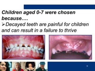 Children aged 0-7 were chosen
because….
Decayed teeth are painful for children
and can result in a failure to thrive

13

 