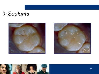  Sealants

19

 