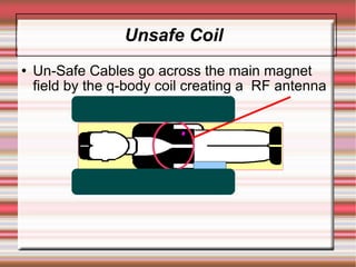 Unsafe Coil
   Un-Safe Cables go across the main magnet
    field by the q-body coil creating a RF antenna
 