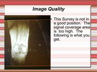 Image Quality
          This Survey is not in
           a good position. The
           signal coverage area
           is too high. The
           following is what you
           get.
 