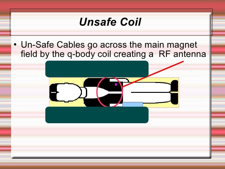 Coil Safe Positioning in MRI