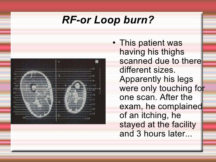 Coil Safe Positioning in MRI