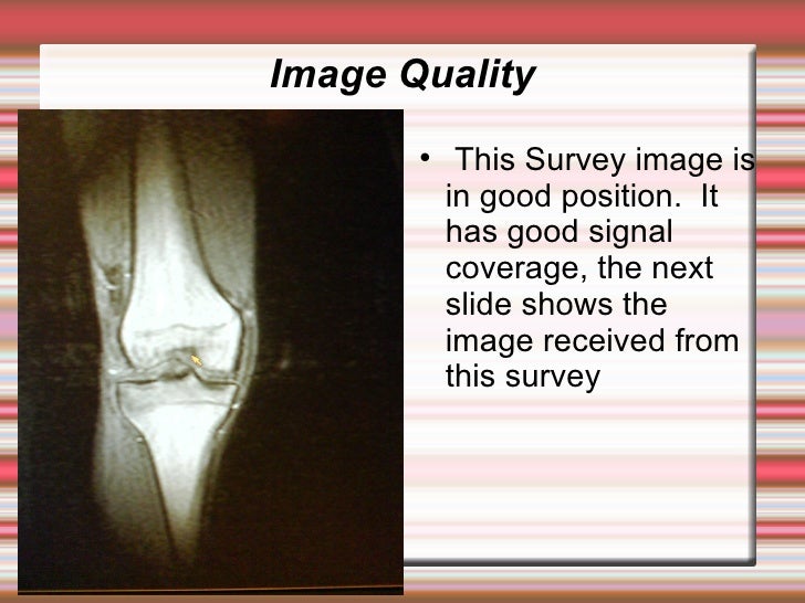 Coil Safe Positioning in MRI
