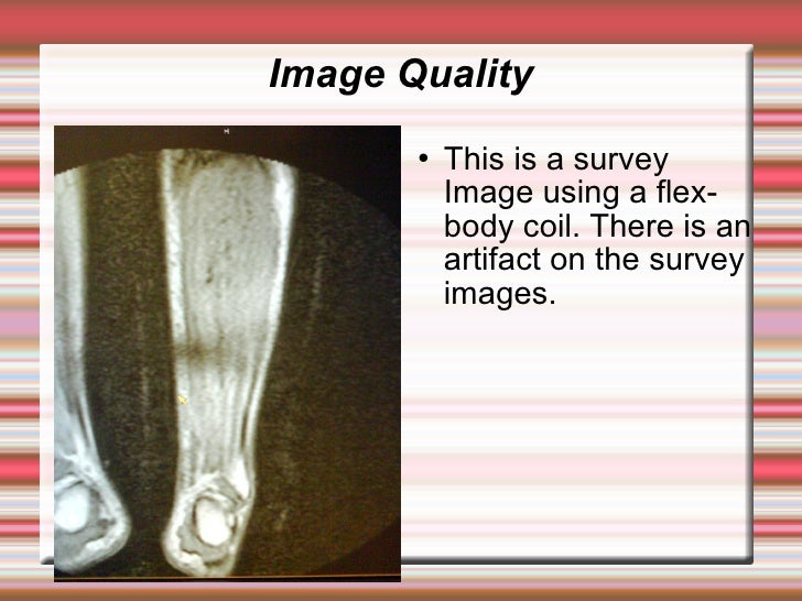 Coil Safe Positioning in MRI
