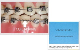 Orthodontic Coil spring