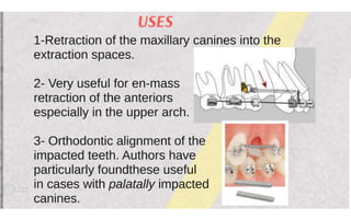 Orthodontic Coil spring