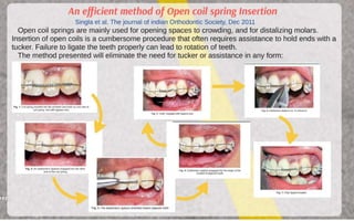 Orthodontic Coil spring