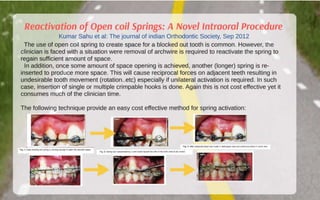 Orthodontic Coil spring